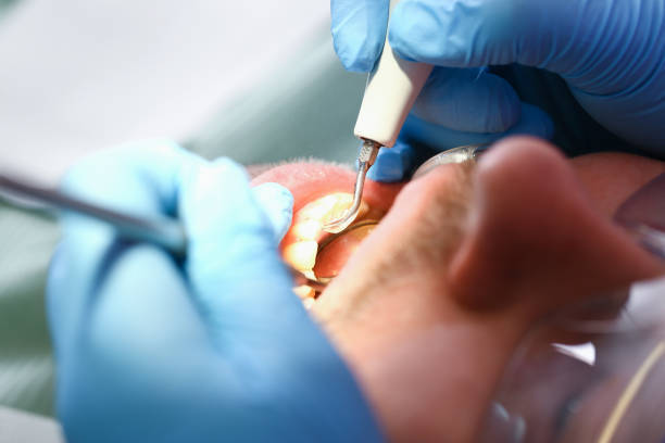 Best Emergency Dental Services for Seniors in Crystal Lakes, OH