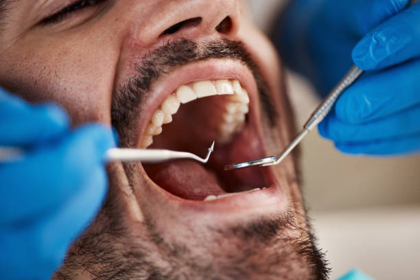 Best Mobile Emergency Dentist in Crystal Lakes, OH